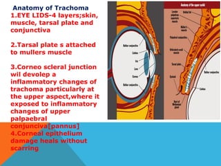 Trachom Trachoma | PPT