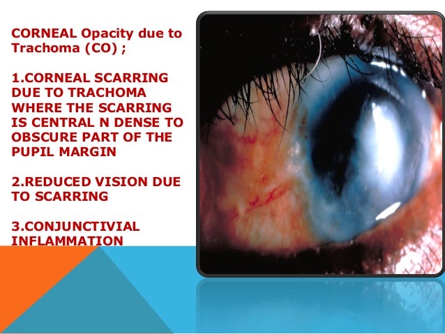 4-6 grade grading sheet Trachoma