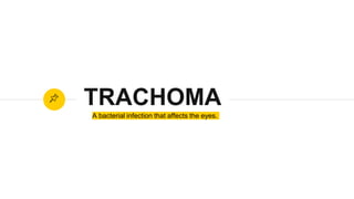 A bacterial infection that affects the eyes.
TRACHOMA
 