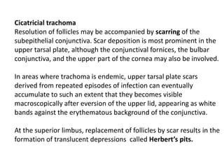 Cicatricial trachoma
Resolution of follicles may be accompanied by scarring of the
subepithelial conjunctiva. Scar deposition is most prominent in the
upper tarsal plate, although the conjunctival fornices, the bulbar
conjunctiva, and the upper part of the cornea may also be involved.
In areas where trachoma is endemic, upper tarsal plate scars
derived from repeated episodes of infection can eventually
accumulate to such an extent that they becomes visible
macroscopically after eversion of the upper lid, appearing as white
bands against the erythematous background of the conjunctiva.
At the superior limbus, replacement of follicles by scar results in the
formation of translucent depressions called Herbert’s pits.
 