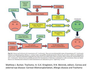 Matthew J. Burton. Trachoma. In: G.K. Krieglstein, R.N. Weinreb, editors. Cornea and
external eye disease: Corneal Allotransplantation, Allergic disease and Trachoma
 