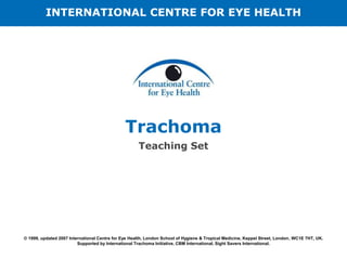 Trachoma
Teaching Set
© 1999, updated 2007 International Centre for Eye Health, London School of Hygiene & Tropical Medicine, Keppel Street, London, WC1E 7HT, UK.
Supported by International Trachoma Initiative, CBM International, Sight Savers International.
INTERNATIONAL CENTRE FOR EYE HEALTH
 