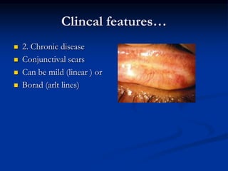 Trachoma.pptx