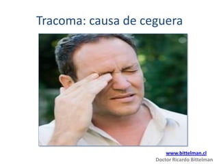 Tracoma: causa de ceguera




                        www.bittelman.cl
                    Doctor Ricardo Bittelman
 