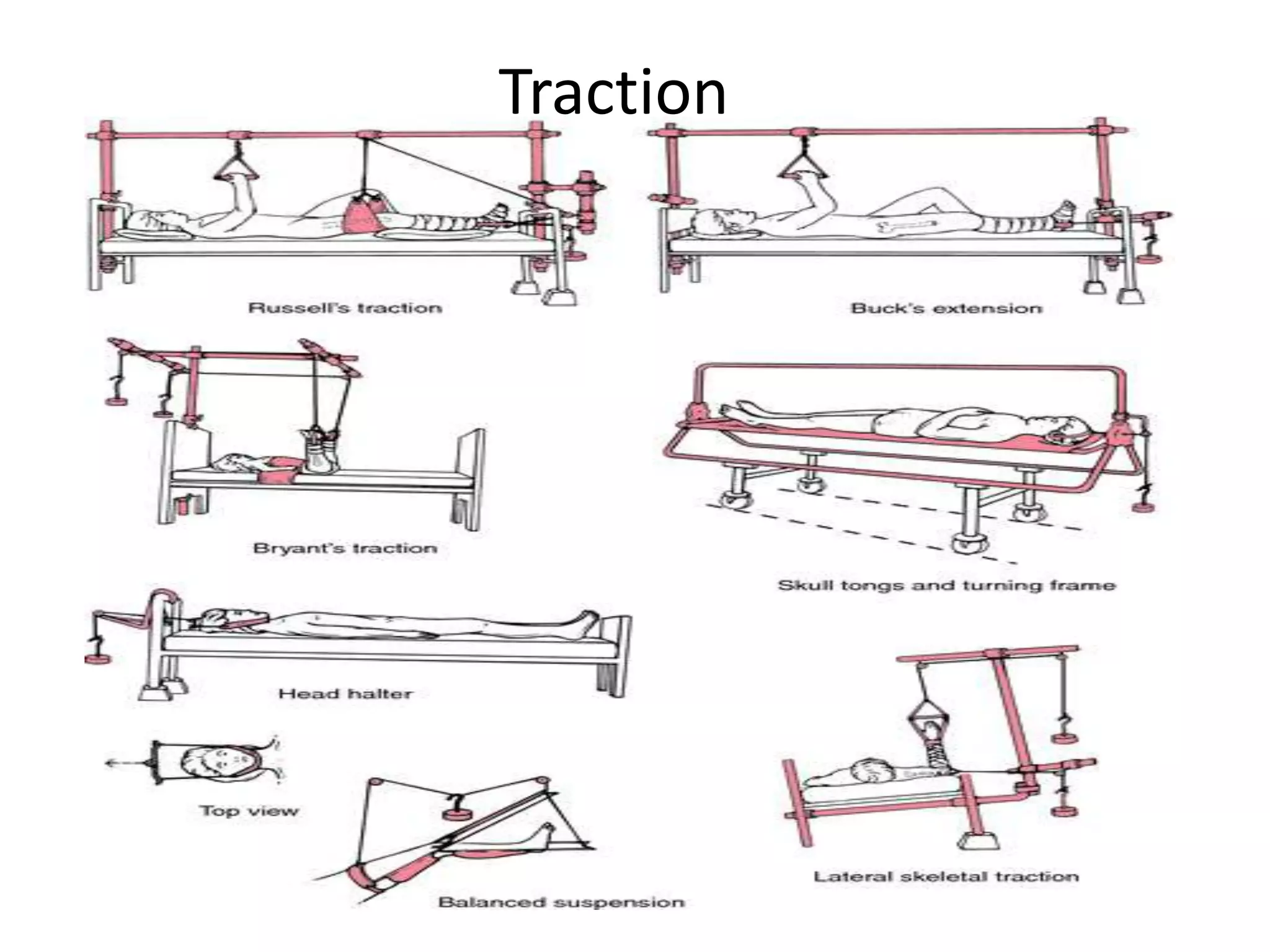Traction