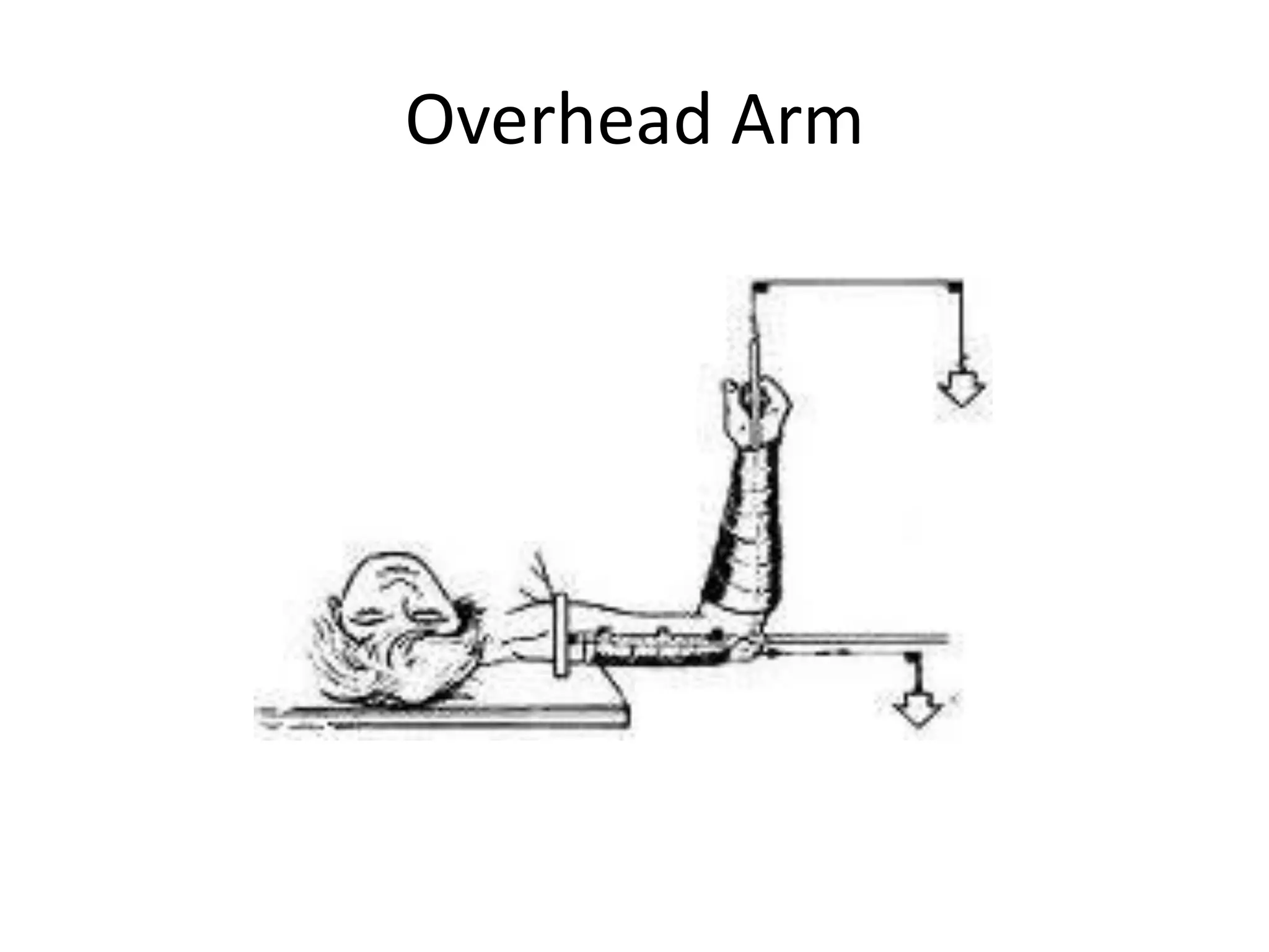 Overhead Arm