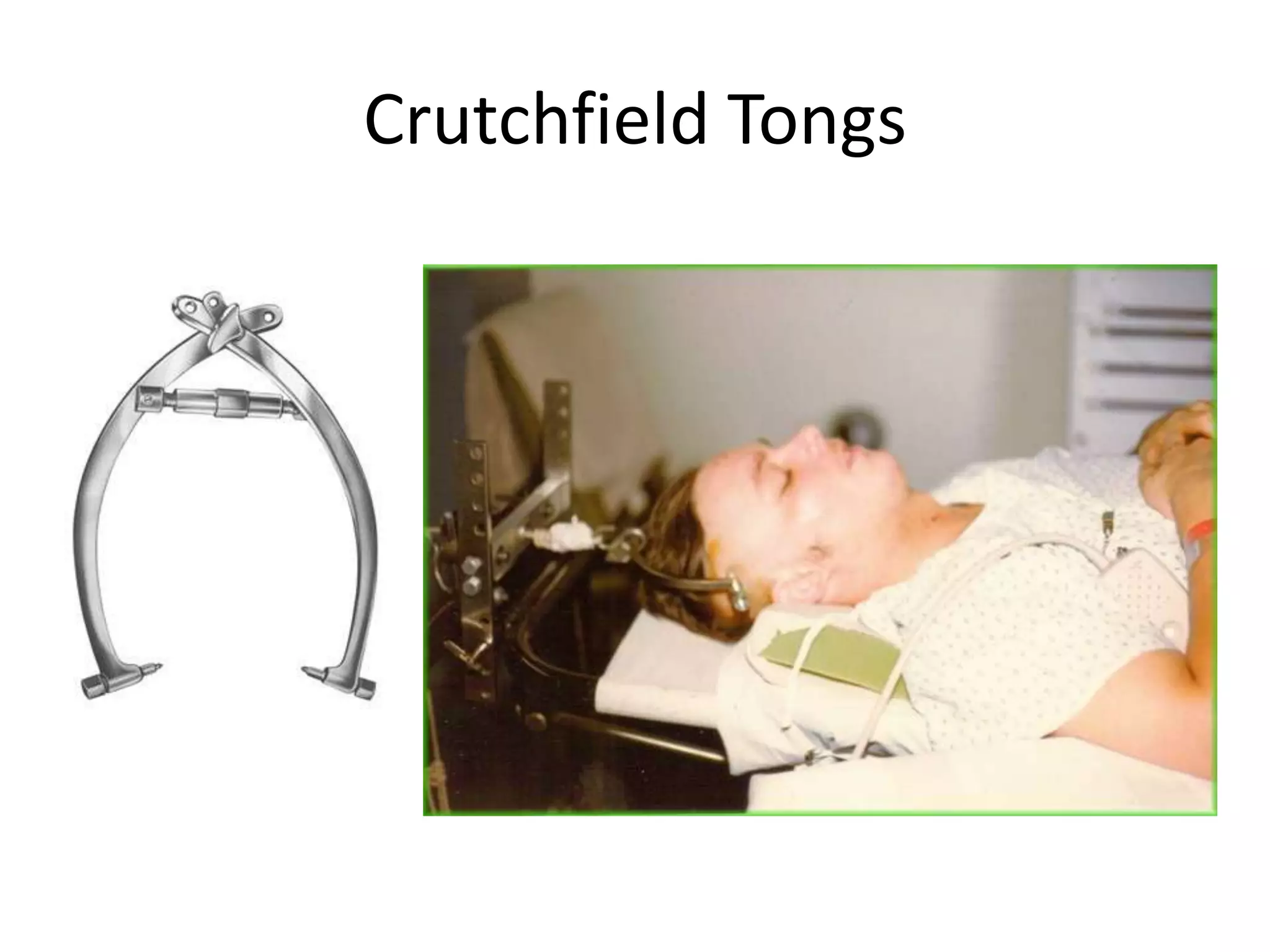 Crutchfield Tongs