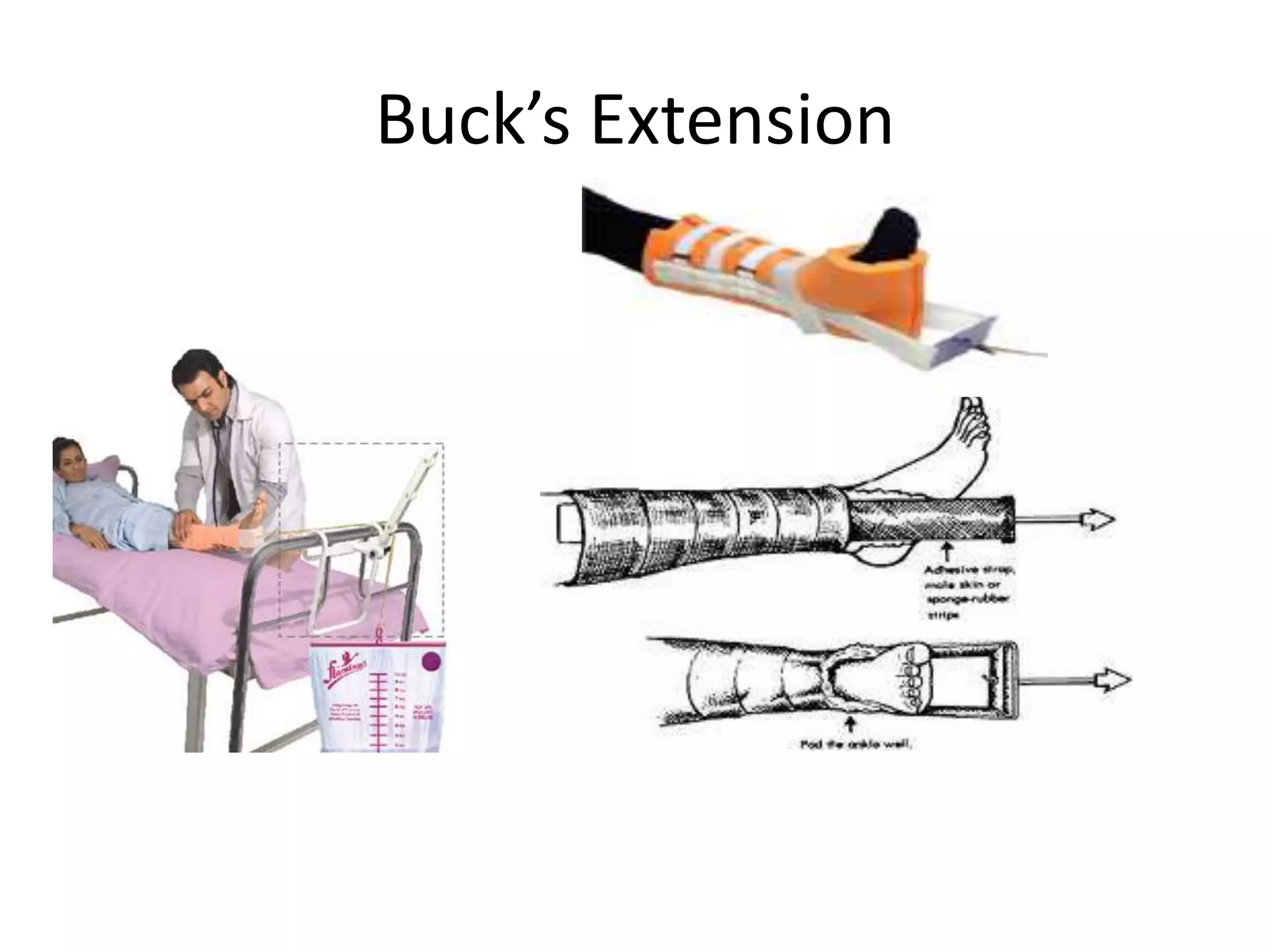 Buck’s Extension