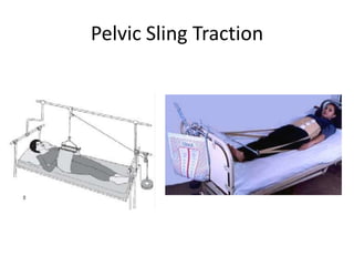 Pelvic Sling Traction