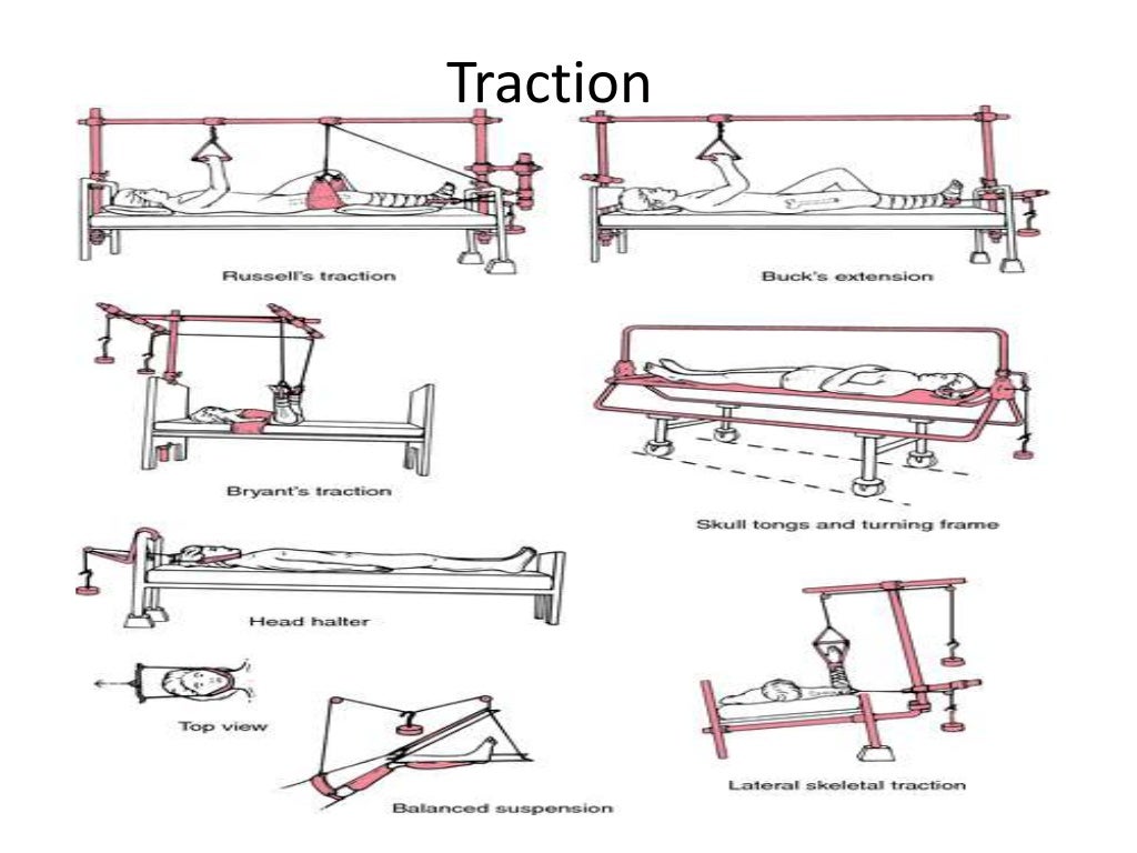 Traction Traction