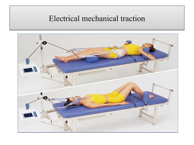 Compression Traction Signe Traction | PDF | First Aid | Injuries