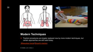 Modern Techniques
 Traction procedures are largely replaced now by more modern techniques, but
certain approaches are still used today:
Milwaukee brace/ Bryant's traction
BY ROMMEL LUIS C. ISRAEL III
30
 