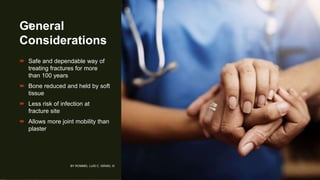 General
Considerations
 Safe and dependable way of
treating fractures for more
than 100 years
 Bone reduced and held by soft
tissue
 Less risk of infection at
fracture site
 Allows more joint mobility than
plaster
BY ROMMEL LUIS C. ISRAEL III
5
 