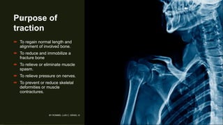 Purpose of
traction
 To regain normal length and
alignment of involved bone.
 To reduce and immobilize a
fracture bone
 To relieve or eliminate muscle
spasm.
 To relieve pressure on nerves.
 To prevent or reduce skeletal
deformities or muscle
contractures.
BY ROMMEL LUIS C. ISRAEL III
6
 