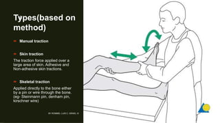 Types(based on
method)
 Manual traction
 Skin traction
The traction force applied over a
large area of skin. Adhesive and
Non-adhesive skin tractions.
 Skeletal traction
Applied directly to the bone either
by a pin or wire through the bone.
(eg- Steinmann pin, denham pin,
kirschner wire)
BY ROMMEL LUIS C. ISRAEL III
8
 