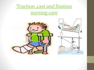 Traction ,cast and fixation
nursing care
 