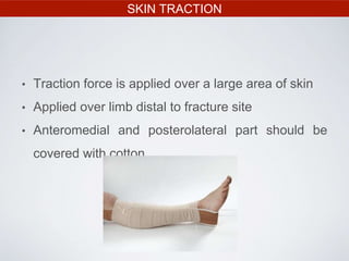 SKIN TRACTION
• Traction force is applied over a large area of skin
• Applied over limb distal to fracture site
• Anteromedial and posterolateral part should be
covered with cotton
 