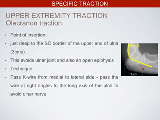 SPECIFIC TRACTION
UPPER EXTREMITY TRACTION
• Point of insertion:
• just deep to the SC border of the upper end of ulna
(3cms)
• This avoids ulnar joint and also an open epiphysis
• Technique:
• Pass K-wire from medial to lateral side - pass the
wire at right angles to the long axis of the ulna to
avoid ulnar nerve
Olecranon traction
 