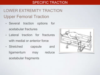 SPECIFIC TRACTION
LOWER EXTREMITY TRACTION
• Several traction options for
acetabular fractures
• Lateral traction for fractures
with medial or anterior force
• Stretched capsule and
ligamentum may reduce
acetabular fragments
Upper Femoral Traction
 