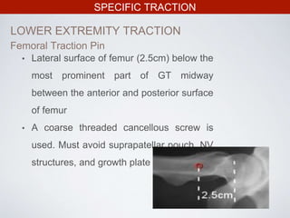 SPECIFIC TRACTION
LOWER EXTREMITY TRACTION
• Lateral surface of femur (2.5cm) below the
most prominent part of GT midway
between the anterior and posterior surface
of femur
• A coarse threaded cancellous screw is
used. Must avoid suprapatellar pouch, NV
structures, and growth plate in children
Femoral Traction Pin
 