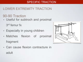 SPECIFIC TRACTION
LOWER EXTREMITY TRACTION
• Useful for subtroch and proximal
3rd femur fx
• Especially in young children
• Matches flexion of proximal
fragment
• Can cause flexion contracture in
adult
90-90 Traction
 