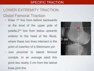 SPECIFIC TRACTION
LOWER EXTREMITY TRACTION
Distal Femoral Traction
• Draw 1st line from before backwards
at the level of the upper pole of
patella,2nd line from below upwards
anterior to the head of the fibula,
where these two lines intersect is the
point of insertion of a Steinmann pin
• Just proximal to lateral femoral
condyle. In an average adult this
point lies nearly 3 cm from the lateral
knee joint line
 