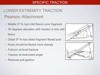 SPECIFIC TRACTION
LOWER EXTREMITY TRACTION
• Middle 3rd fx had mild flexion prox fragment
• 30 degrees elevation with traction in line with
femur
• Distal 3rd fx has distal fragment flexed post
• Knee should be flexed more sharply
• Fulcrum at level fracture
• Traction at downward angle
• Reduces pull gastroc
Pearson Attachment
 