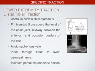 SPECIFIC TRACTION
LOWER EXTREMITY TRACTION
• Useful in certain tibial plateau fx
• Pin inserted 5 cm above the level of
the ankle joint, midway between the
anterior and posterior borders of
the tibia
• Avoid saphenous vein
• Place through fibula to avoid
peroneal nerve
• Maintain partial hip and knee flexion
Distal Tibial Traction
 