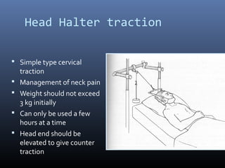 Head Halter traction
 Simple type cervical
traction
 Management of neck pain
 Weight should not exceed
3 kg initially
 Can only be used a few
hours at a time
 Head end should be
elevated to give counter
traction
 
