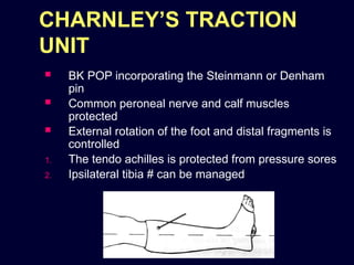Distal Traction Rotation traction_in_orthopaedics new orthoapedics .pptx