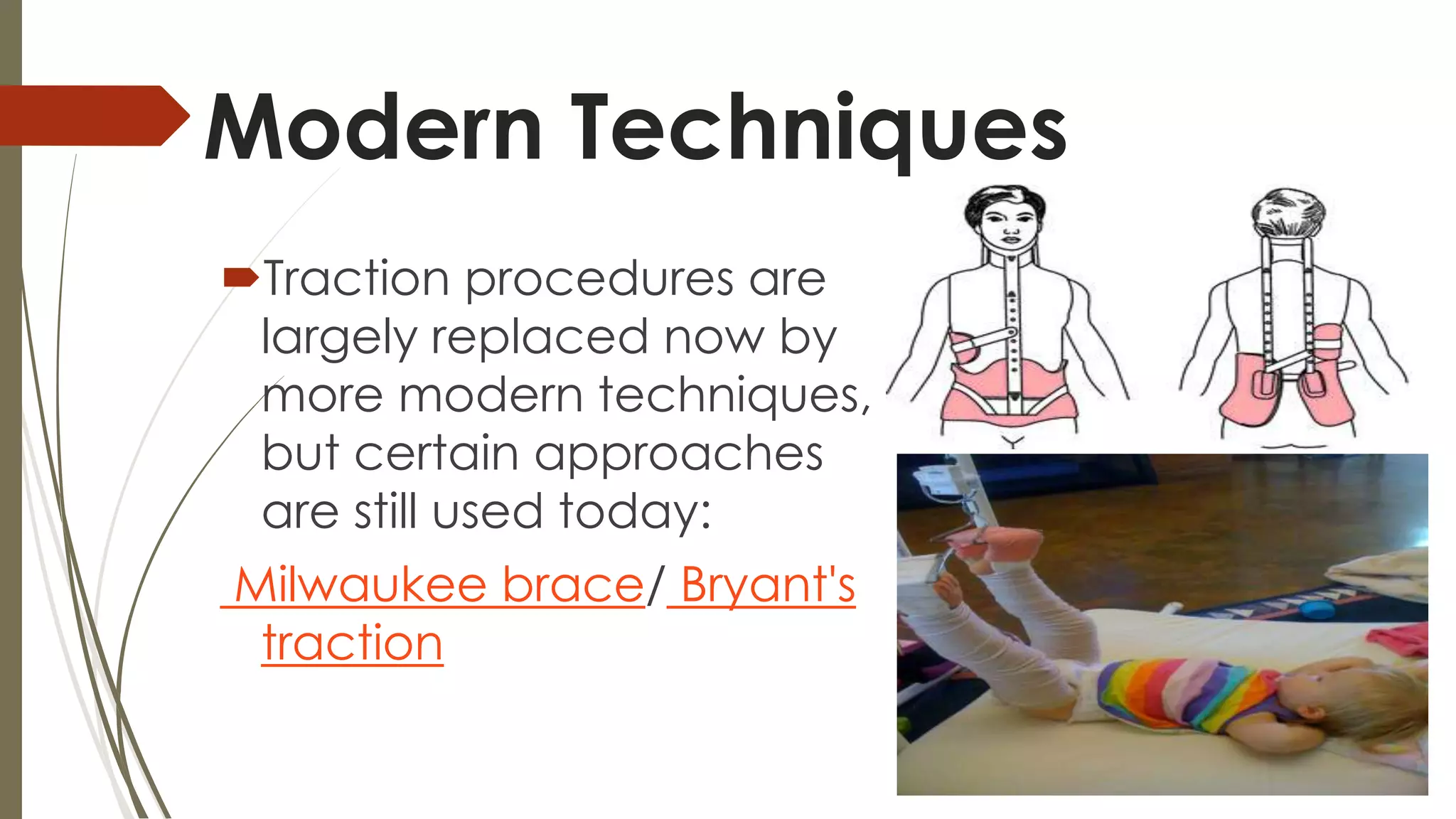 Traction Use Traction(orthopedics) | PPTX