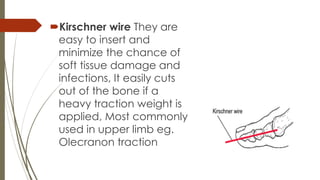 Kirschner wire They are 
easy to insert and 
minimize the chance of 
soft tissue damage and 
infections, It easily cuts 
out of the bone if a 
heavy traction weight is 
applied, Most commonly 
used in upper limb eg. 
Olecranon traction 
 