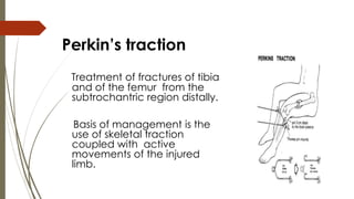Perkin’s traction 
Treatment of fractures of tibia 
and of the femur from the 
subtrochantric region distally. 
Basis of management is the 
use of skeletal traction 
coupled with active 
movements of the injured 
limb. 
 