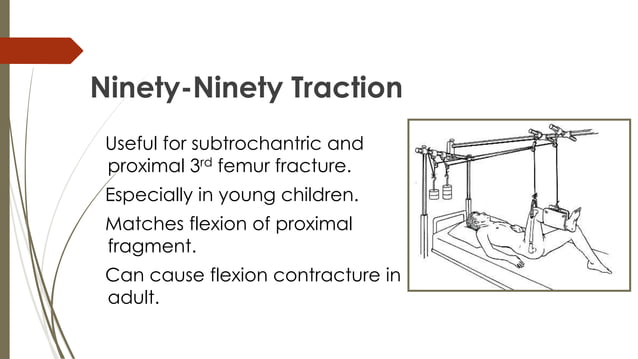 [Pdf] Keeping The Traction On In Orthopaedics – DQUSC