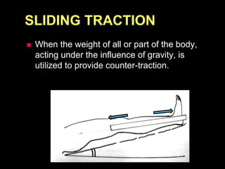 SLIDING TRACTION
 When the weight of all or part of the body,
acting under the influence of gravity, is
utilized to provide counter-traction.
 