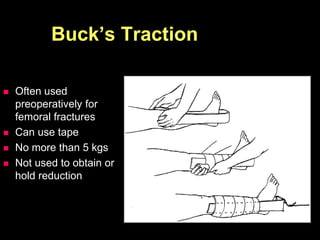 Buck’s Traction
 Often used
preoperatively for
femoral fractures
 Can use tape
 No more than 5 kgs
 Not used to obtain or
hold reduction
 