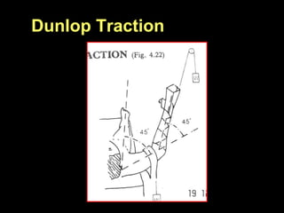 Dunlop Traction
 