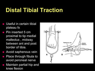 Distal Tibial Traction
 Useful in certain tibial
plateau fx
 Pin inserted 5 cm
proximal to tip medial
malleolus , midway
between ant and post
border of tibia.
 Avoid saphenous vein
 Place through fibula to
avoid peroneal nerve
 Maintain partial hip and
knee flexion
 