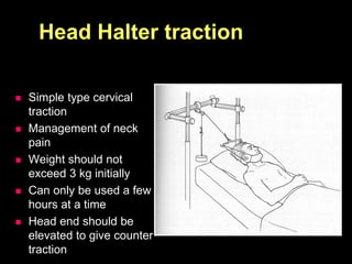 Head Halter traction
 Simple type cervical
traction
 Management of neck
pain
 Weight should not
exceed 3 kg initially
 Can only be used a few
hours at a time
 Head end should be
elevated to give counter
traction
 