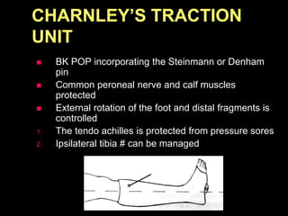 CHARNLEY’S TRACTION
UNIT
 BK POP incorporating the Steinmann or Denham
pin
 Common peroneal nerve and calf muscles
protected
 External rotation of the foot and distal fragments is
controlled
1. The tendo achilles is protected from pressure sores
2. Ipsilateral tibia # can be managed
 