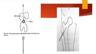 Lower Limb traction | PPTX
