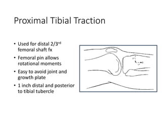Distal Traction Rotation TRACTION pptx.,on 29.01.2024^_v_1_0.ppt