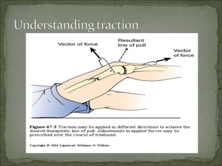 Compression Traction Signe Tractions | PPT