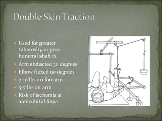 Traction Rd Fundus Tractions | PPT