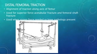 Distal Traction Rotation Tractions | PPTX