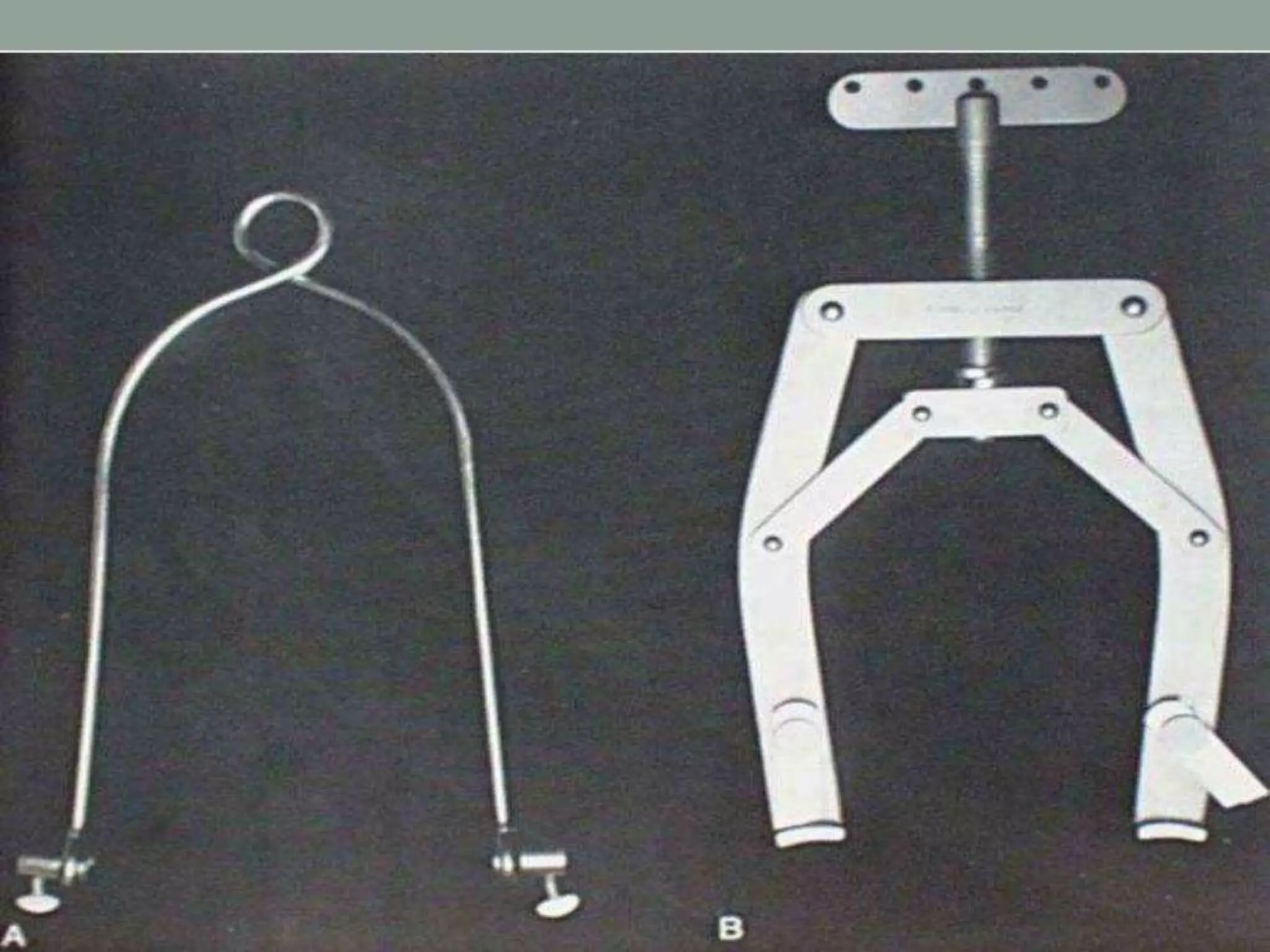 Traction Use Tractions in Orthopaedics.ppt