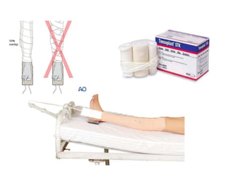 Traction Use Tractions in Orthopaedics.ppt