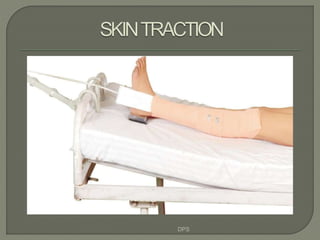 Traction Use Tractions in orthopaedics by dr. d. p. swami | PPTX