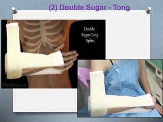 (2) Double Sugar - Tong
 