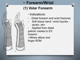 • Forearm/Wrist
(1) Volar Forearm
• Indications:
- Distal forearm and wrist fractures
- Soft tissue hand / wrist injuries -
sprain, etc•
- Applied from distal
palmer crease to 2/3
forearm
• Allows elbow and
finger ROM
.
 